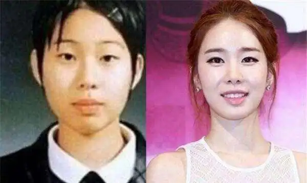 韩剧整容女明星_韩国整容女明星颜值变化_崔智友蔡琳尹恩惠刘仁娜刘荷娜韩恩贞金宣儿郑丽媛李多海朴诗妍